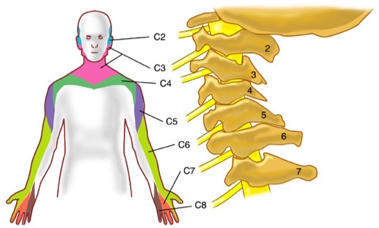 Segmenti cervicobrachialgie